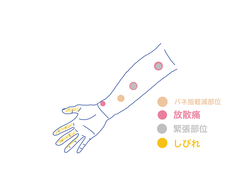 手根管